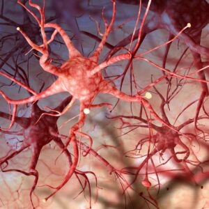 نوروفیبروماتوز 